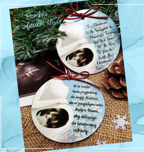 BOMBKA ZE ZDJĘCIEM USG TWOJEGO DZIECKA + NAPIS - BŁĘKITNA